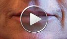 Adoucissement des traits du pourtour de la bouche